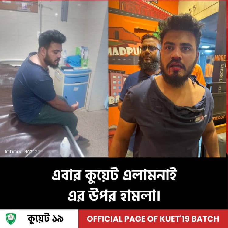 কুয়েট অ্যালামনাইয়ের ওপর হামলা
